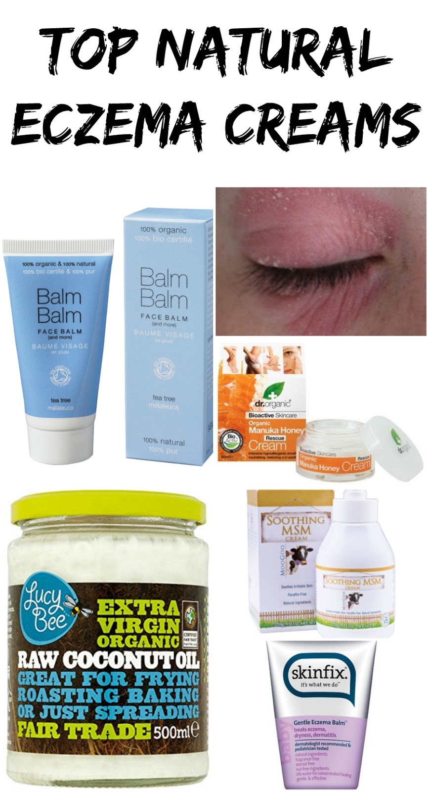 Top 5 Natural Eczema Creams For Sensitive Skin Lux Life London