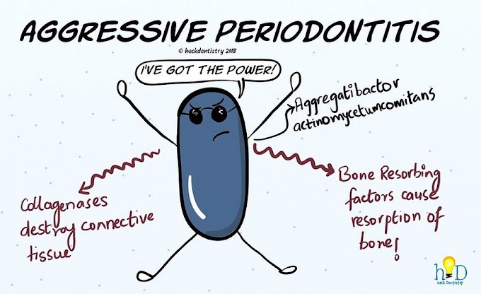 PERIODONTICS: Aggressive Periodontitis - Introduction, Classification & Pathogenesis
