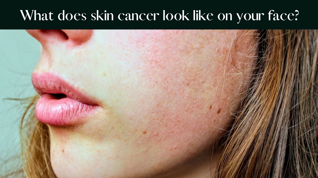 skin-cancer-types- causes-symptoms-pictures