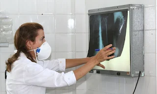 Brasil registra 200 casos de tuberculose por dia.