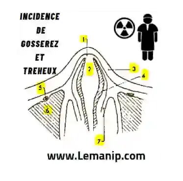 ANATOMIE RADIOLOGIQUE DU PYRAMIDE NASALE VUE VERTICALE (Incidence de GOSSEREZ et TREHEUX)