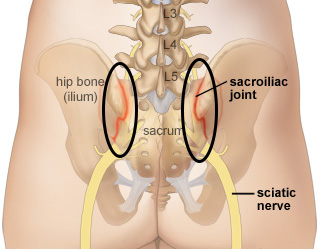 Main Causes of Pain in the Hip, Thigh, and Groin