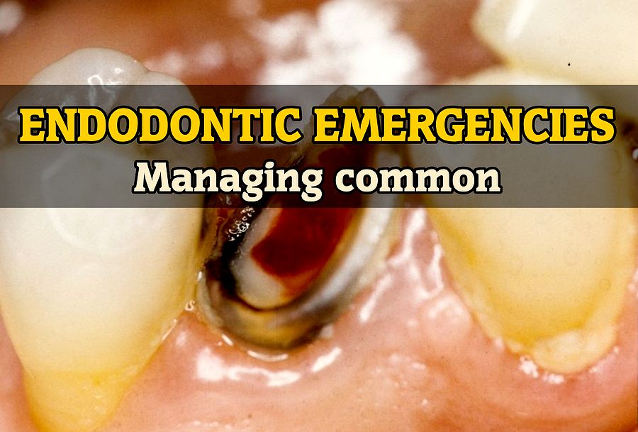 Managing Common Endodontic Emergencies Dr. Glassman