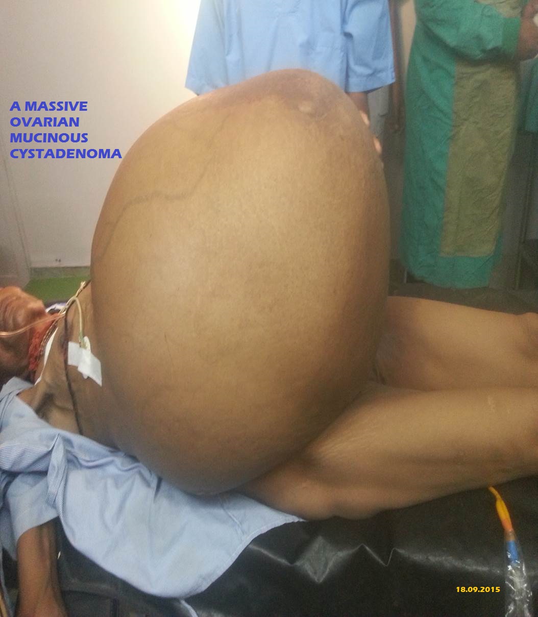 Journal Of Postgraduate Gynecology Obstetrics 2015