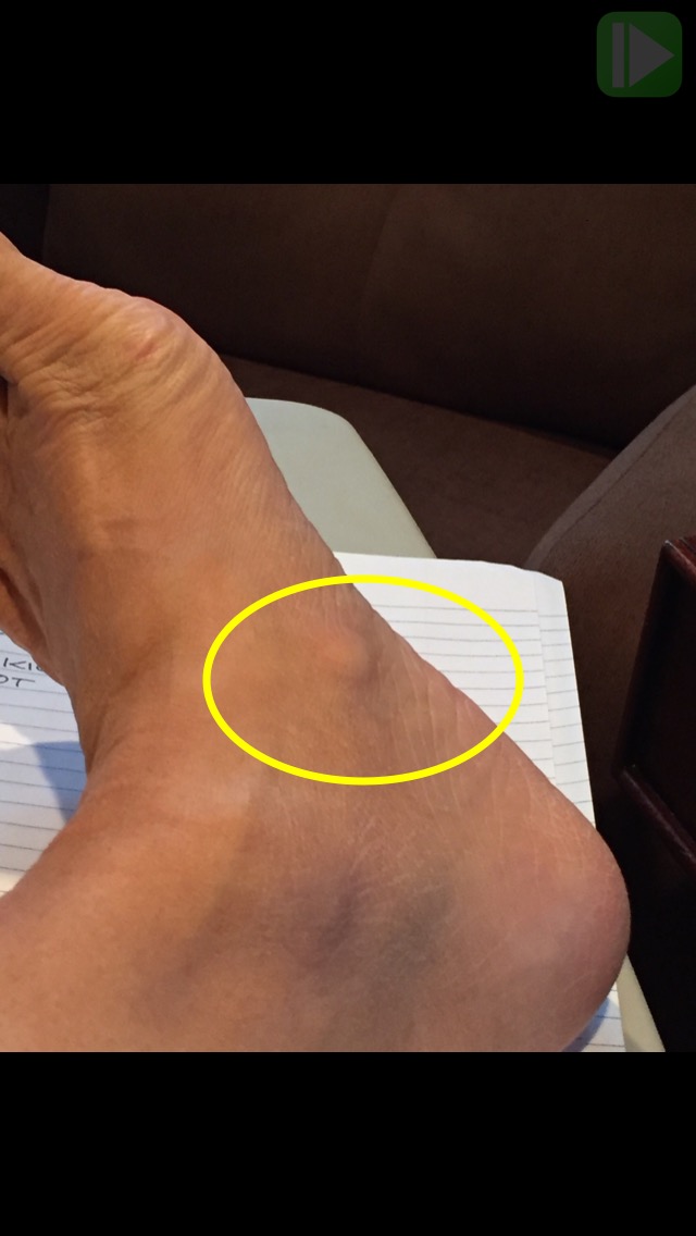 WALTZ JUMP Figure Skating Over Age 60 March 2016