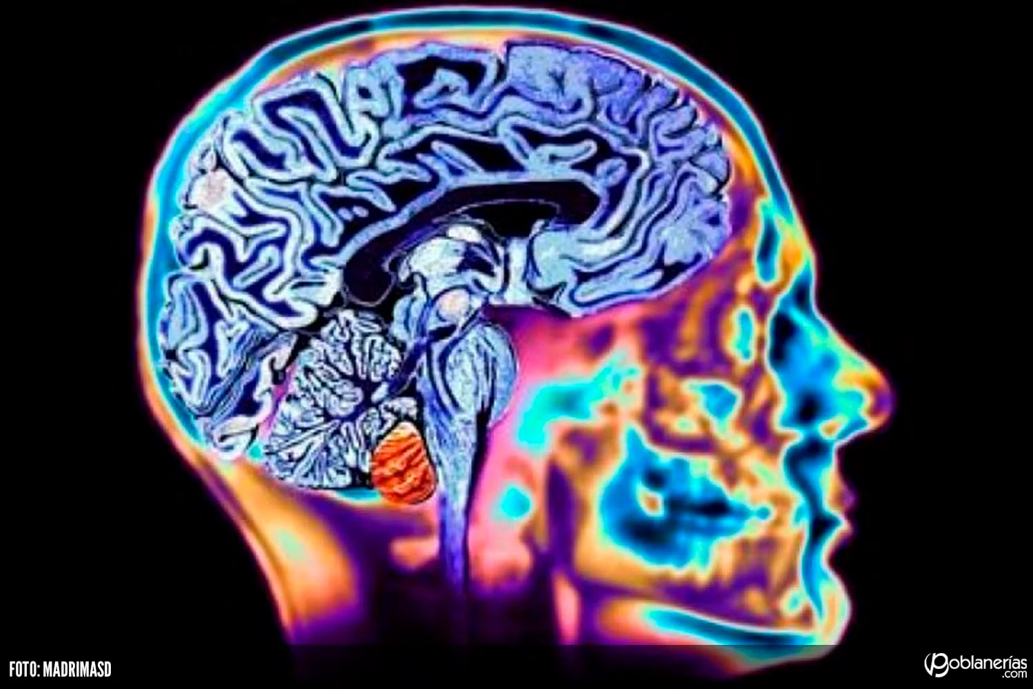 Lush Huntington's Disease Successfully Treated For First Time Image for Mobile