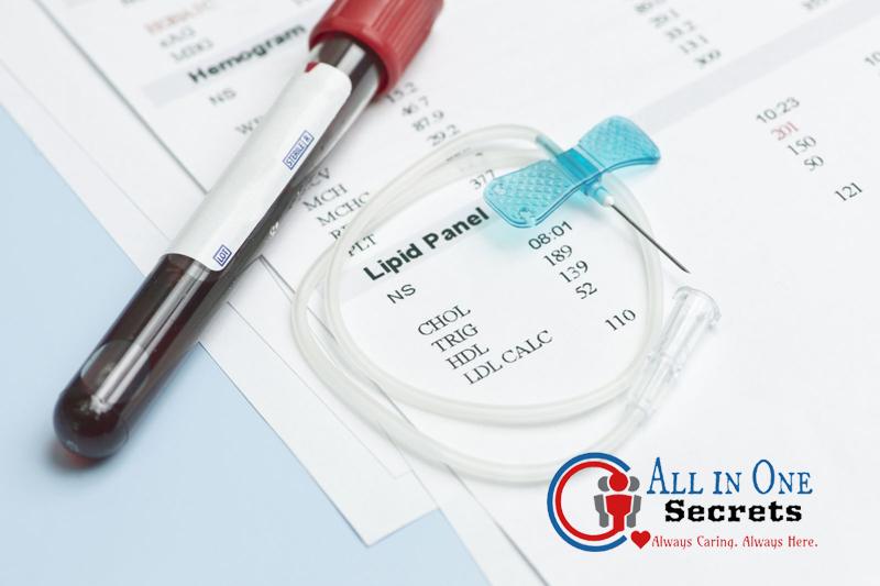 How to Read Cholesterol Level Chart? Live Healthy Live Long