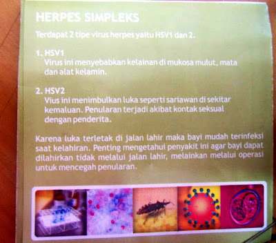 Herpes-Simplex
