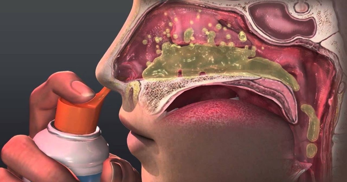 كيف تستخدم غسول الأنف بطريقة صحيحة وأفضل الأنواع