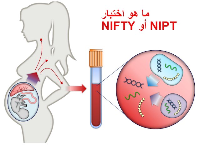 ما هو اختبار NIFTY  أو NIPT؟