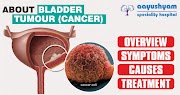 About Bladder Tumour (Cancer) - by Aayushyam Speciality Hospital, Naranpura, Ahmedabad.