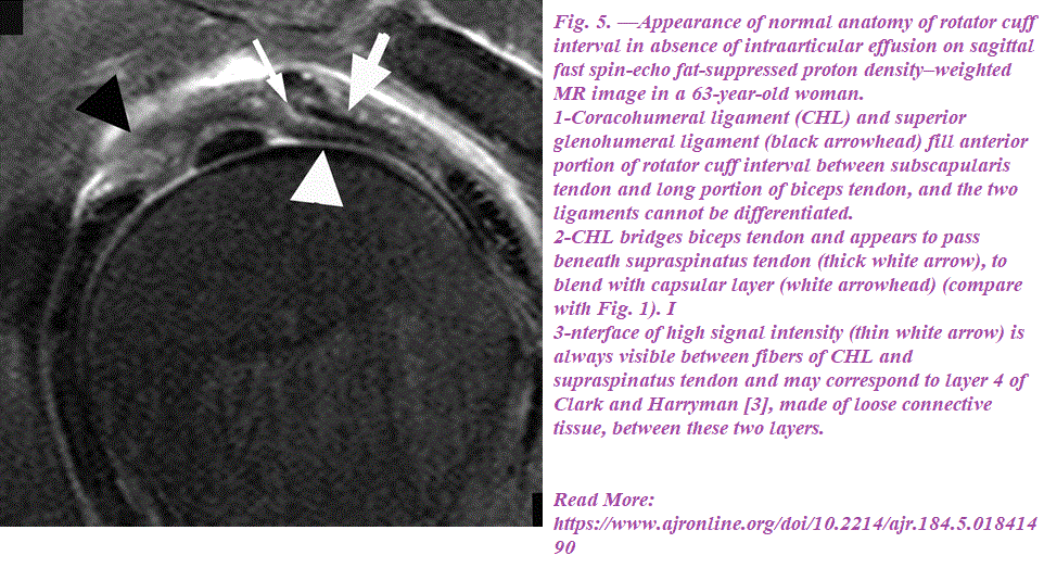 MRI of the Rotator Interval Capsule