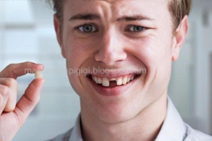 Mimpi Gigi Gingsul Atas Copot - Lektur Indo