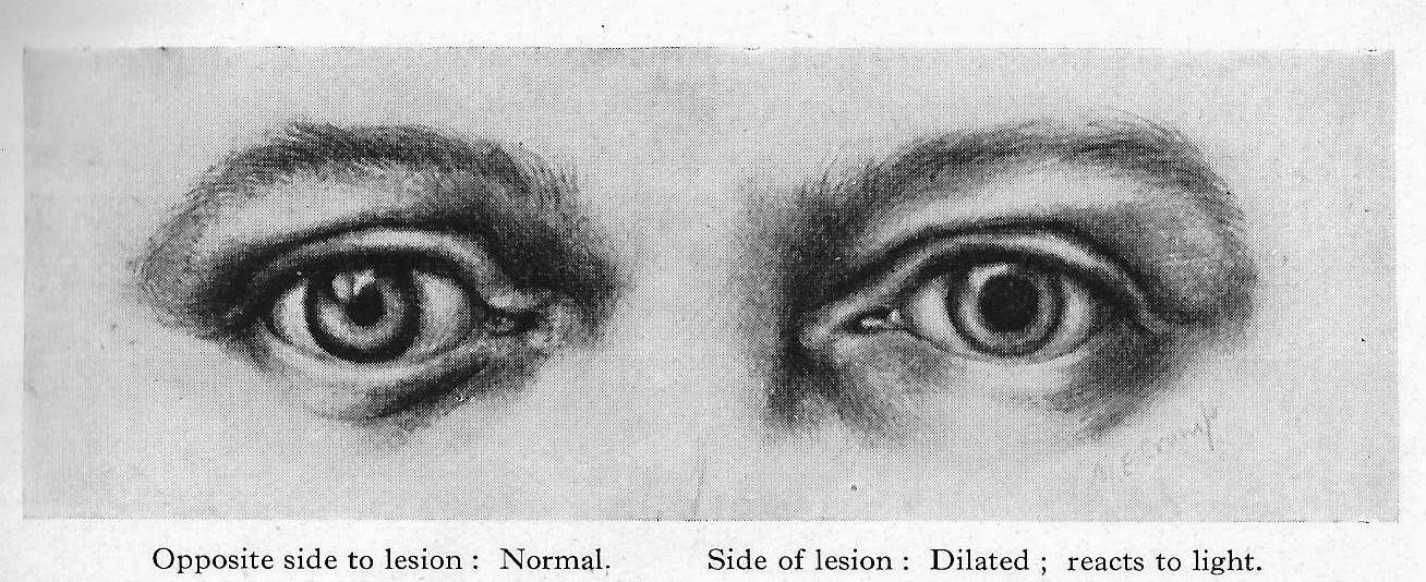 Western Fictioneers WE'LL HAVE TO OPEN HIS HEAD UP!