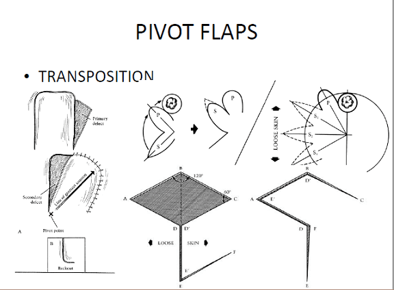 pivot flaps