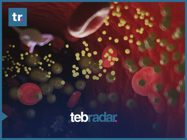 9 تجارب تساعد على خفض نسبة الكولسترول بسرعة في أسبوع