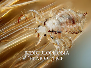  Pediculophobia, fear of lice