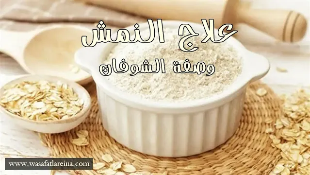 علاج النمش بوصفات طبيعية