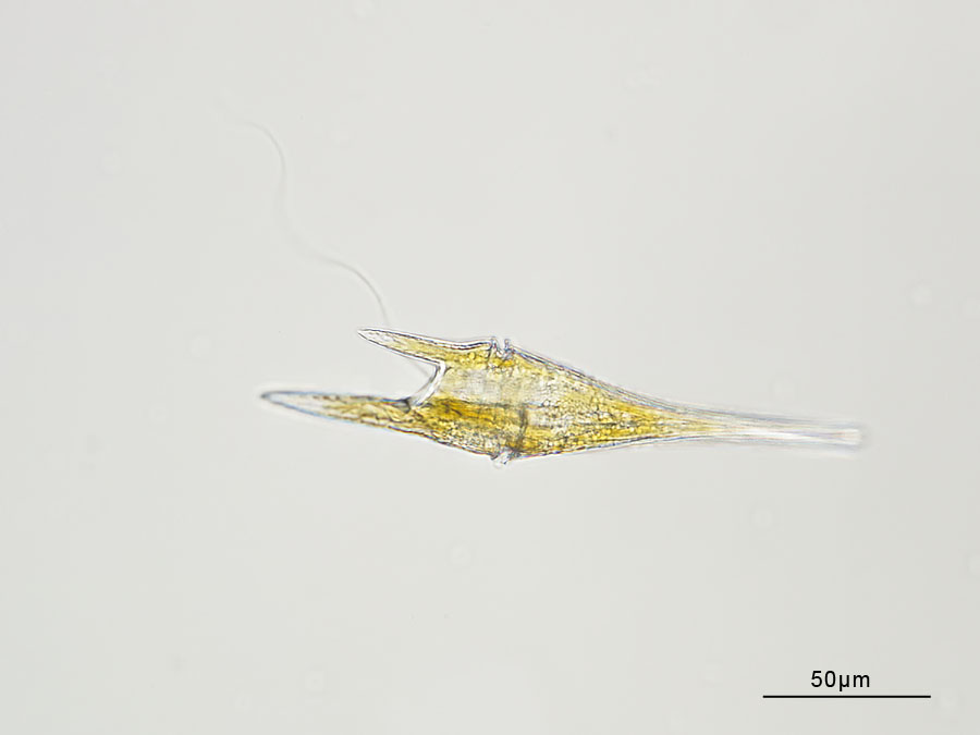  2 ceratium furca