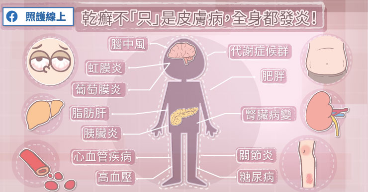 乾癬不「只」是皮膚病，全身都發炎！