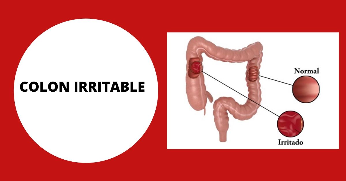 Que probióticos son aconsejables para el colon irritable