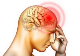 الالتهاب السحائي.. الأعراض وطرق الوقاية الالتهاب السحائي.. الأعراض وطرق الوقاية