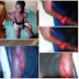 Lady Brutally Cuts Her Stepdaughter With Knife In Ikorodu Area Of Lagos - Graphic Photos