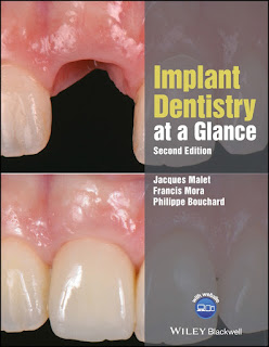 Implant Dentistry at a Glance 2nd Edition