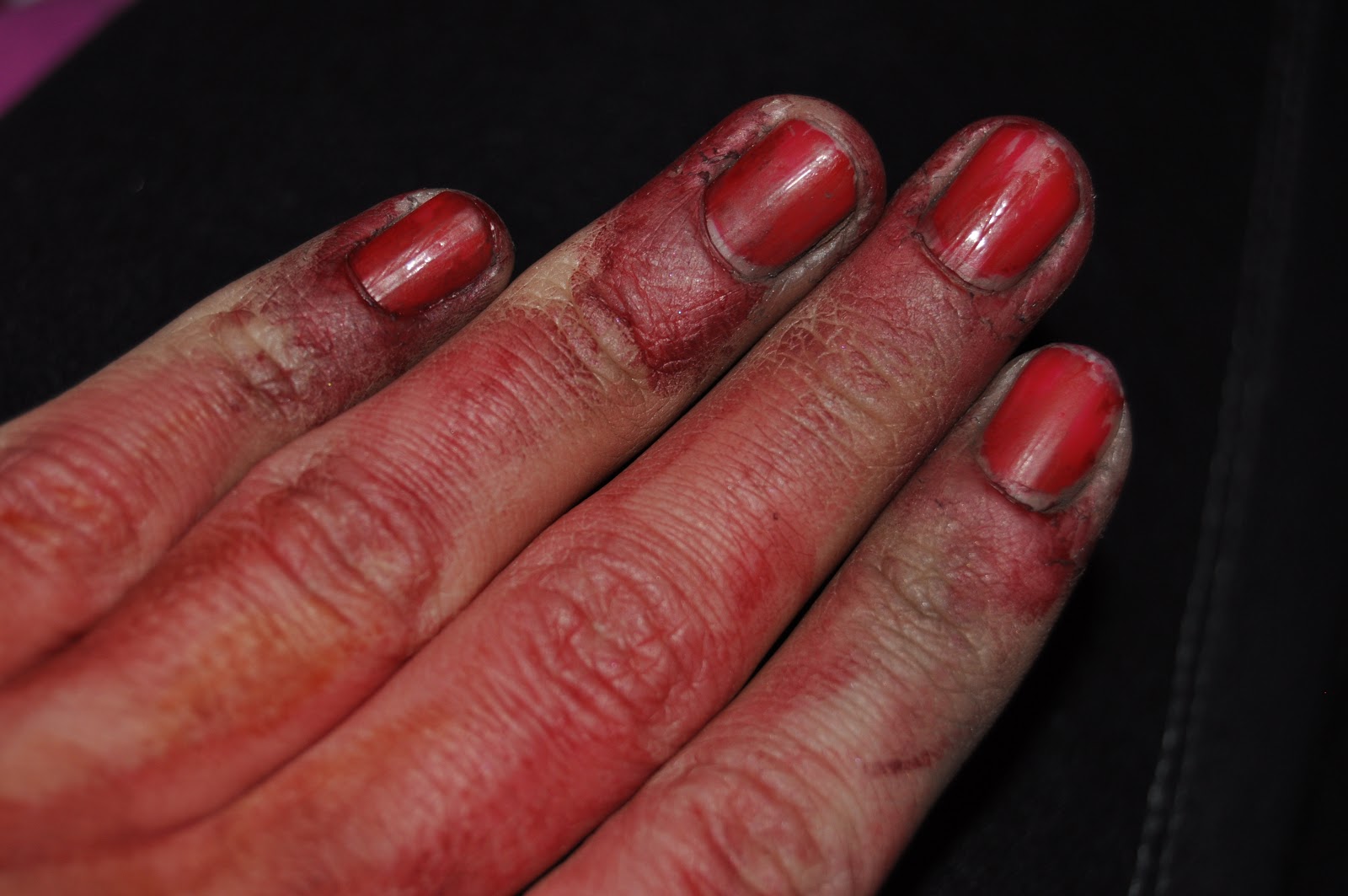 Se Ronger Les Ongles Jusqu Au Sang Les mains Halloweenesques. | 23heures59, le blog