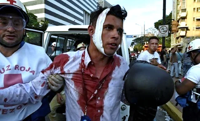 Más de 50 heridos en el segundo día de protestas antigobierno en Venezuela