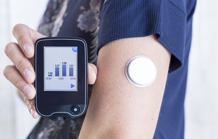 InsureBlog Medicare Coverage for Insulin Pumps