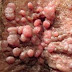 Gatal dan munculnya bintik pada vagina thumbnail