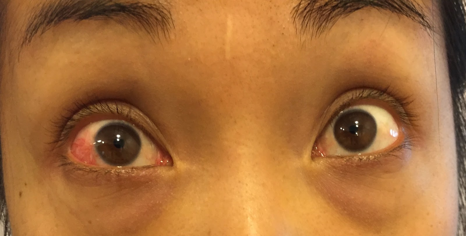 My eye Eyes the least red it will be (first waking up in the morning)