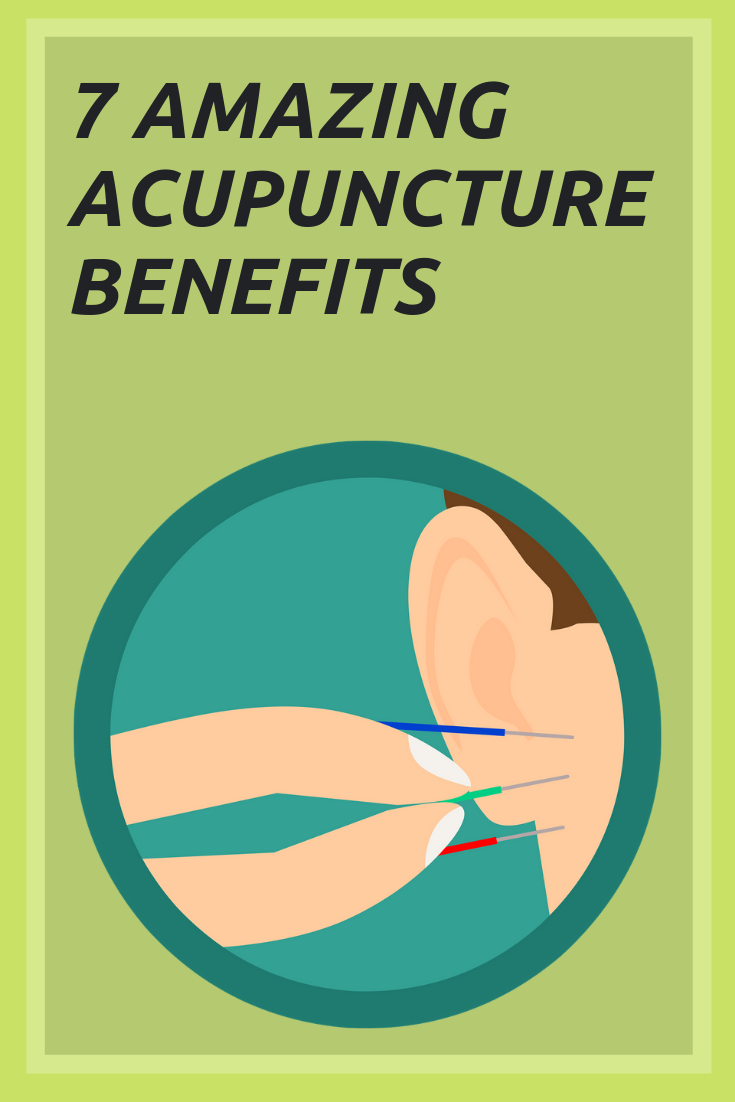 7 Acupuncture Benefits Smeh Beautytips