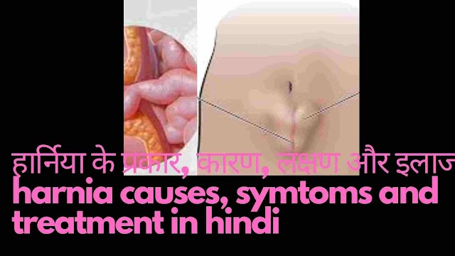 हार्निया प्रकार, कारण, लक्षण और इलाज - harnia home treamment in hindi
