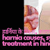 हर्निया से बचाव का घरेलू इलाज, लक्षण और कारण - harnia treatment in hindi
