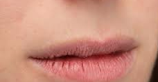 Cara Mudah Mengatasi Bibir Bayi Kering Atau Pecah Pecah Wiwa Pedia