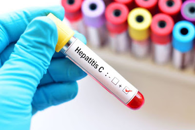 Hepatitis_C