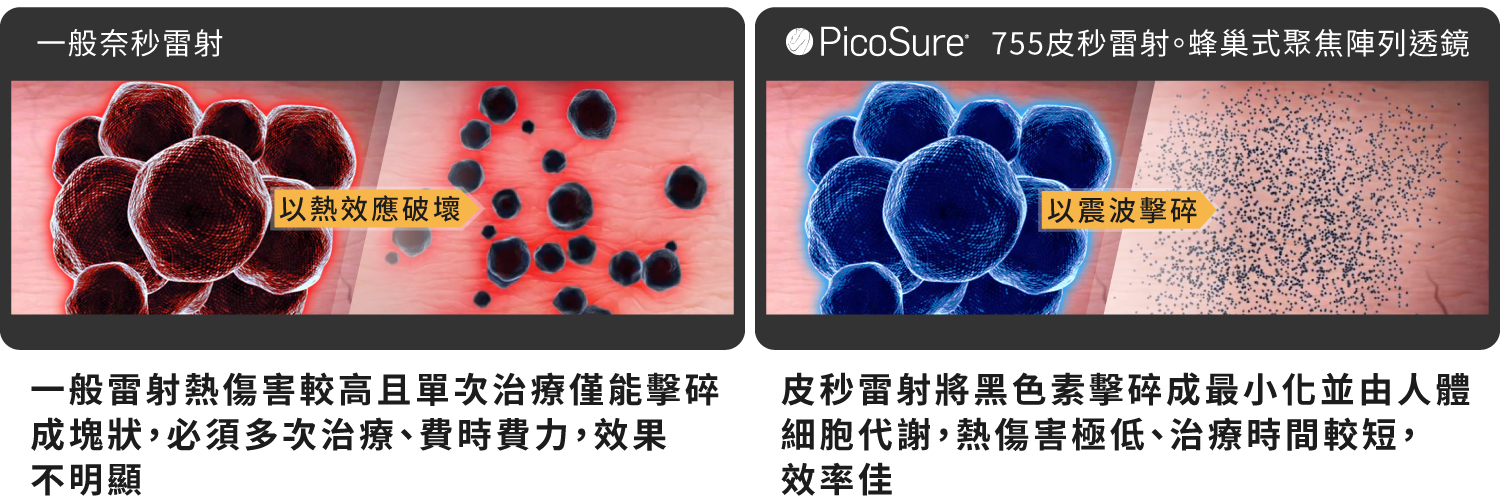 02-brightskin-Picosecond laser-PicoSure-Shrink pores-Dermatology recommended 