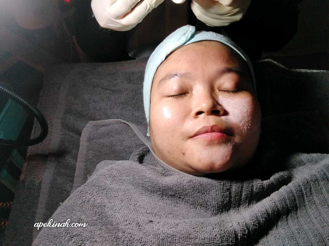 Buat Rawatan OxyPeel C Untuk Merawat Parut Di Dr Medispa & Wellness Buat Rawatan OxyPeel C Untuk Merawat Parut Di Dr Medispa & Wellness