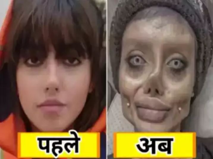 Bollywood-actress-horrible-surgery