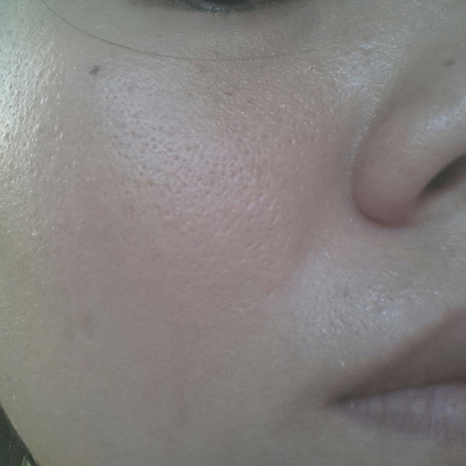 Summer Moments in Thailand ZPORE instant pore refiner perfecteur