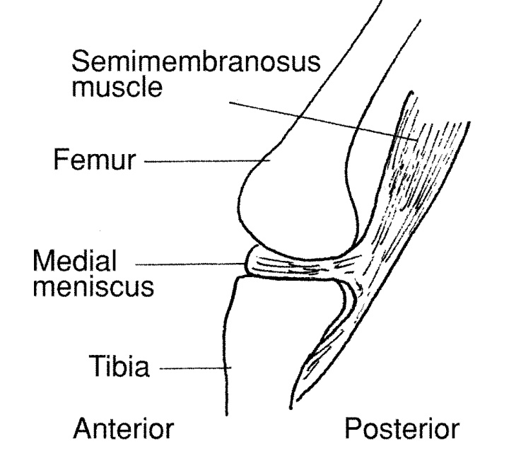 Active Knee stabilizers