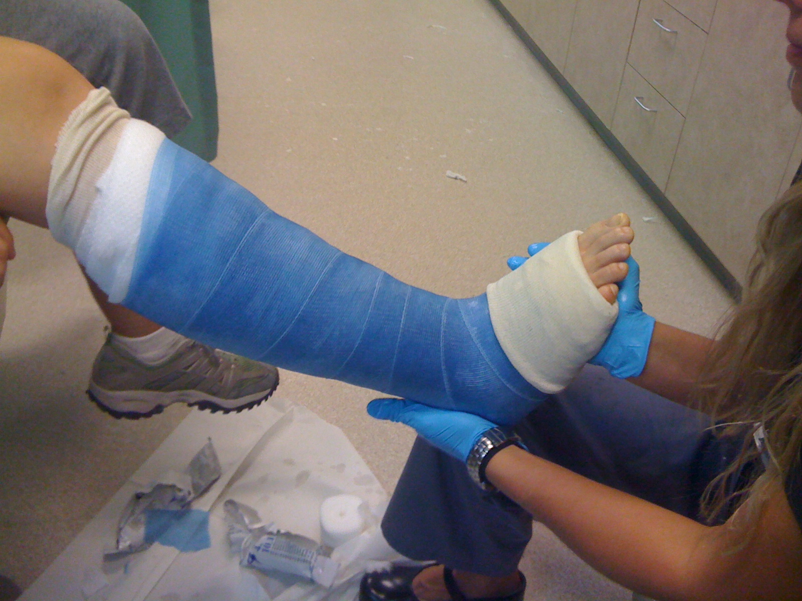 Drats! My leg is broken.