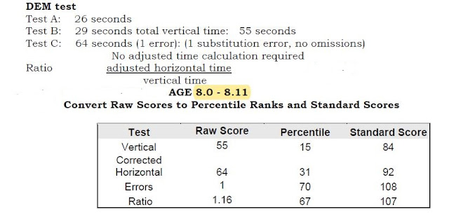 進達眼鏡-視光新知分享: Developmental Eye Movement Test (DEM) DEM測試