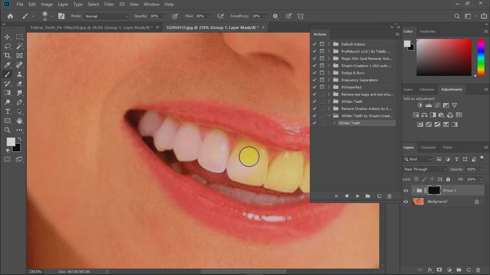 Free Download 1 Click Whiten Teeth Magic Actions