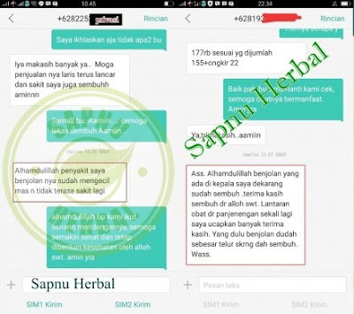 Cara Mengobati Fibroadenoma Mammae (FAM) Tanpa Operasi Cara Mengobati Fibroadenoma Mammae (FAM) Tanpa Operasi