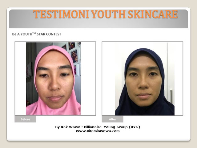 34 Testimoni Youth Skincare Shaklee Terbaru, Youth skincare shaklee, testimoni youth skincare shaklee, Youth Skincare Shaklee : Harga dan Review Pengguna Youth Shaklee, testimoni youth skincare shaklee, testimoni youth skincare shaklee 34 Testimoni Youth Skincare Shaklee Terbaru, Youth skincare shaklee, testimoni youth skincare shaklee, Youth Skincare Shaklee : Harga dan Review Pengguna Youth Shaklee, testimoni youth skincare shaklee, testimoni youth skincare shaklee