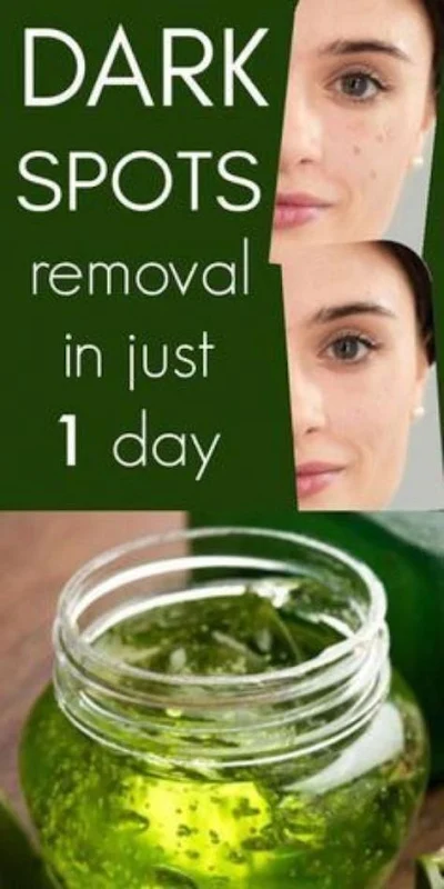 Remove Dark Spots In 1 Day With This Natural 3 Ingredient Recipe