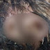Menina é internada com infestação de larvas de mosca na cabeça